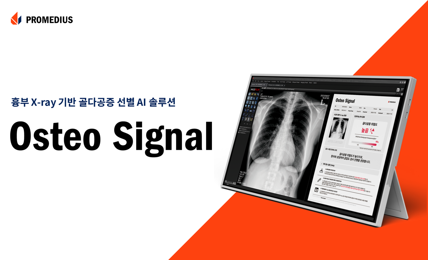 프로메디우스